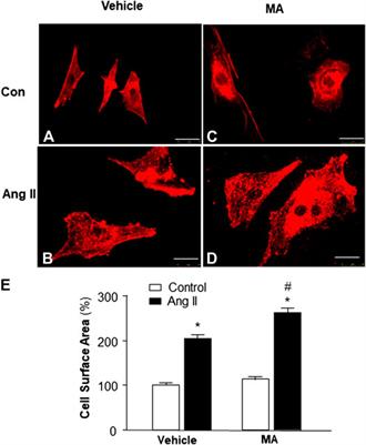 Role of PI3-Kinase in Angiotensin II-Induced Cardiac Hypertrophy: Class I Versus Class III